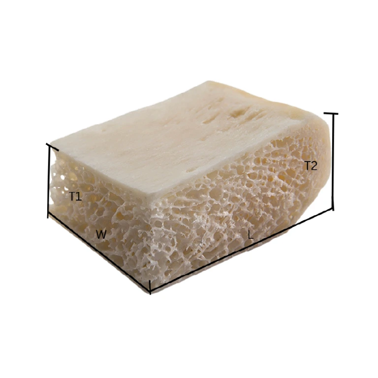 Tri-cortical Block (Iliac Crest
Wedge)