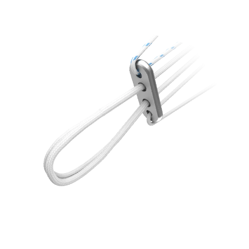 FixButton Fixation Device